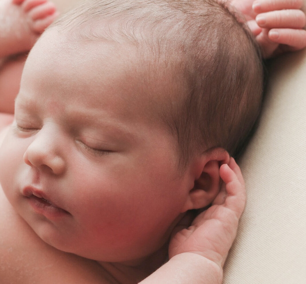 ¿Borrador mágico en la piel? Esto es lo que debe hacer Magic Eraser Eye – Tienda Urbaniak Skin MD