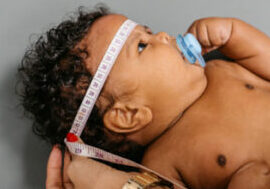 ¿Es seguro pasar la aspiradora durante el embarazo? Leé esto primero Lesiones de nacimiento causadas por complicaciones de la extracción al vacío